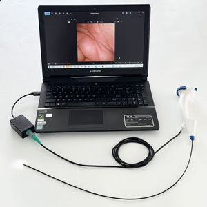 Sensorendo 2.5/2.8/3.1/3.8/5.2/5.8mm 30/60 cm uzunluk Mega piksel tek kullanımlık USB Video esnek laringoskop elektrik Powered - Product Image 3