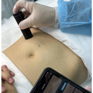 NUOJO Dermopigmentación OEM Corporal Negra Inalámbrica Portátil Semipermanente para Remodelación de la Piel Probador de Piel - Product Image 4