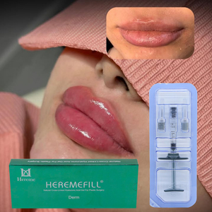 Vente en gros mondiale de produits de comblement cutané pour les lèvres, gel HA injectable 1ml 2ml, pour personnalisation de seringues et approvisionnement professionnel - Product Image 2