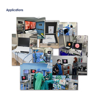 Système de caméra endoscopique portable Full HD IKEDA YKD-9101H 1/2.3'' CMOS