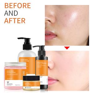 Coffrets de Soins Visage et Corps Éclaircissants à Base de Plantes, Sans Cruauté Animale, Kit de Soins à l'Acide Kojique pour Adultes - Product Image 5