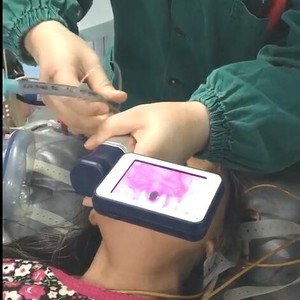 BESDATA lame de laryngoscope vidéo électrique pas cher prix outil d'intubation en acier réutilisable pour la gestion des voies respiratoires - Product Image 3