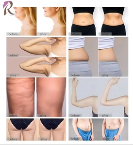 Máquina Comercial de Moldeado en Frío con 5 Manijas, Equipo de Belleza Antiarrugas con Renovación de Colágeno para Spa y Tiendas - Product Image 4