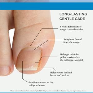 ETRUN ALISA Marque privée Anti-infection Paronychie Onychomycose Fongique Soins des <span class=keywords><strong>pieds</strong></span> Sérum Gel d'élimination des champignons des ongles Huile de récupération - Product Image 5