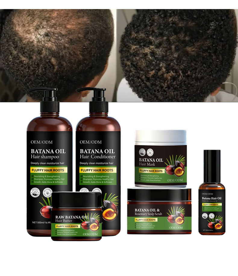 Factory Supply Batana Oil Organic Nourishing Conditioner Kit Regrowth Anti Hair Loss Black Hair Shampoo For Hair Growth