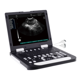 Resolusi Tinggi Tinggi terpasang 3D 4D warna <span class=keywords><strong>Doppler</strong></span> 15 inci Ecografo portatel PW <span class=keywords><strong>CW</strong></span> jantung gema mesin Ultrasound - Product Image 1