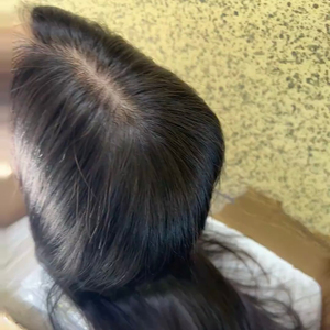 <span class=keywords><strong>Perruque</strong></span> médicale en cheveux humains pour femmes souffrant de <span class=keywords><strong>chimiothérapie</strong></span>, en convalescence de cancer, d'alopécie, ou de perte totale de cheveux - Product Image 3
