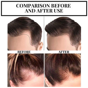 Retratamiento rápido para el hogar, herramienta protectora de aire para el hogar - Product Image 4