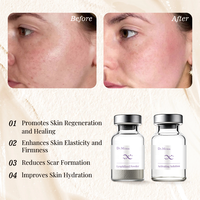 Sérum de collagène recombinant de qualité médicale 4g, formule lyophilisée, anti-âge, soin du visage après procédure, soin de la peau médical