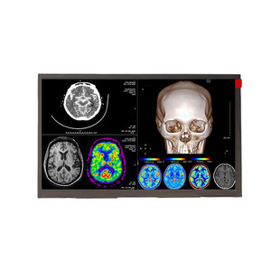 จอแสดงผล TFT LCD ขนาด 8 นิ้ว ความละเอียด 1280x720 ความสว่างสูง 750nits IPS LVDS รองรับอุณหภูมิกว้าง - Product Image 1