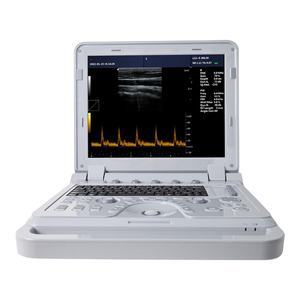 Mesin USG Doppler Pseudo Warna CONTEC CMS600P2plus Sistem USG Doppler Spektral Pulsa - Product Image 1