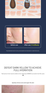 <span class=keywords><strong>Cepillo</strong></span> Limpiador <span class=keywords><strong>Facial</strong></span> Multifuncional de Lujo Coreano con Dispositivo Integrado de Lifting con Gota de Agua, Reafirmante, Antienvejecimiento, Limpieza Profunda, Spa - Product Image 6