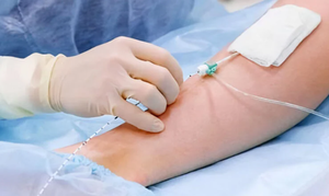 Máquina de Ablación de Venas Varicosas <span class=keywords><strong>con</strong></span> Láser de Cirugía Profesional EVLT de 1470nm, Mini-invasiva, Eliminación de Venas <span class=keywords><strong>con</strong></span> Láser - Product Image 4