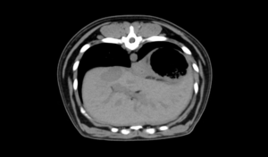 Équipement médical EURVET, système de tomodensitométrie numérique de diagnostic à 16, 24, 32, 64 coupes, scanner CT médical - Product Image 4