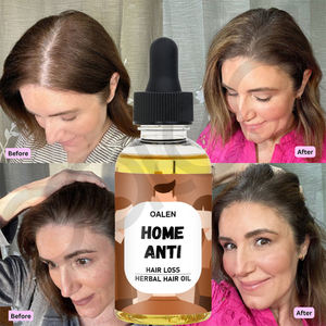 น้ำมันบำรุงเส้นผมสูตรสมุนไพรออร์แกนิค 30 มล. ผลิตภัณฑ์เพื่อการเจริญเติบโตของเส้นผม แบรนด์ส่วนตัว 100% จากธรรมชาติ สำหรับใช้ที่บ้าน ป้องกันผมร่วง - Product Image 2