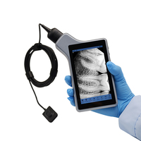 Sistem Gambar Digital Sensor RVG Gigi Portabel VIMEL dengan Layar untuk Klinik Gigi Ukuran 1/Ukuran 2 untuk Anak-anak dan Dewasa