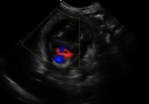 Ecografo Multifunzionale 4D a Colori B/C/D Triplex con Misurazione Vascolare Superficiale IMT per Uso Veterinario - Product Image 5