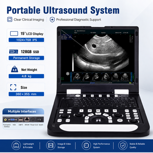 Scanner de diagnostic vétérinaire avec écran LCD de 15 pouces, SSD de 128 Go, système d'<span class=keywords><strong>imagerie</strong></span> clinique de 4,8 kg, appareil d'échographie portable - Product Image 2