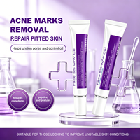 Crema para el Acné con Peróxido de Benzoilo al 5% de Fábrica, Tubo de 45g, Marca Privada OEM, Gel para el Cuidado Facial Anti-Espinillas y Eliminación de Manchas para Piel Grasa con Acné