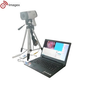 <span class=keywords><strong>Colposcope</strong></span> Video resolusi tinggi untuk pemeriksaan serviks akurat - Product Image 4