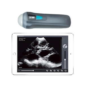 MN-Ultra4 Kinh Tế tuyến tính thăm dò không dây máy siêu âm thú y cho <span class=keywords><strong>Iphone</strong></span> và Android hệ thống - Product Image 5