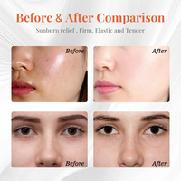 Masque Facial à l'Ectoïne et à l'Acide Hyaluronique : Soulagement des Coups de Soleil, Hydratation et Réparation Post-Procédure pour Soins Esthétiques Médicaux en Salon de Beauté