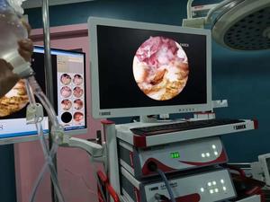 SY-GW800C-N Médical HD endoscope caméra hd laparoscopie et otoscope caméra - Product Image 3