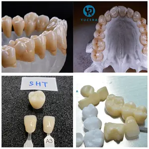 Yucera dental SHT multilayer zirkonia blok zirkonia keramik blok 98mm sistem terbuka untuk gigi cad cam