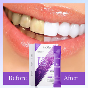 น้ำยาบ้วนปากสูตรใหม่ SADOERV34 รสองุ่นไวท์เทนนิ่ง 10 มล. สำหรับทำความสะอาดฟัน ให้ลมหายใจสดชื่น และฆ่าเชื้อ - Product Image 4