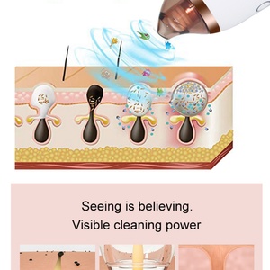 Nouvel appareil de beauté visuel pour éliminer l'acné et les points noirs, nettoyeur de visage à vide pour réduire l'acné - Product Image 3