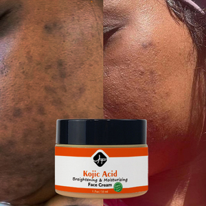 <span class=keywords><strong>Crema</strong></span> Facial Hidratante con Extracto de Caroteno y Ácido Kójico YF OEM para Mujeres de Piel Negra, <span class=keywords><strong>Crema</strong></span> Blanqueadora, Set Completo para Piel Oscura - Product Image 5