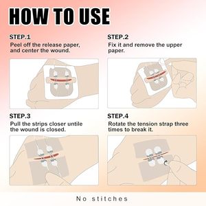 Alat Penutup Luka Kulit Perekat Jahitan Darurat Perlindungan Luka Dapat Dipotong Higienis Zip Stitch Sekali Pakai Bersertifikat CE - Product Image 6
