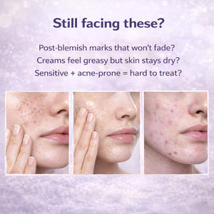 Crème OEM au collagène et à la niacinamide, anti-rides, apaisante, anti-acné, blanchissante, soin de la peau - Product Image 2