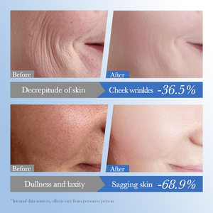 SADOER hydratant ferme rugosité réduire la réparation de la peau resserrer les taches nourrissantes éclaircir la crème pour le visage au <span class=keywords><strong>caviar</strong></span> - Product Image 5