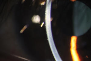 Ophthalmic Portable Digital Spaltlampe KJ5S3 Kamera Tragbare digitale Spaltlampe Einfach zu fotografierende Fotos des vorderen Augen segments - Product Image 2