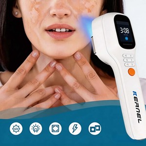 Lámpara de Fototerapia UV Portátil de 308nm, Láser Excimer para Tratamiento de Vitiligo y Psoriasis, <span class=keywords><strong>Crema</strong></span>, Terapia de Luz UV - Product Image 1