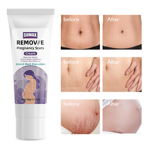 Crema de defensa de las marcas de estiramiento, crema hidratante diaria con ingrediente orgánico, marcas de cuerpo, crema para el vientre de embarazo - Product Image 2