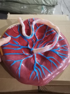 แบบจำลองรกและสายสะดือคุณภาพสูงขนาดเท่าของจริง แสดงรูปแบบรก สายสะดือ ฯลฯ พร้อมสายสะดือสำหรับการพยาบาล - Product Image 6