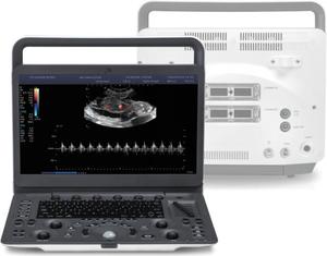 Sistema de Ultrasonido Doppler Color de Diagnóstico de Última Generación Sonoscape E2, Sistema de Ultrasonido Veterinario para Centros Equinos y Clínicas Veterinarias - Product Image 1