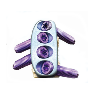 Implant Bedah Kandang Servikal Ortopedi yang Laris untuk Fiksasi Tulang Belakang dengan Sekrup Pengunci Zero-p - Product Image 3