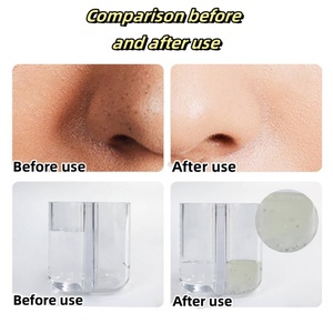เครื่องดูดสิวเสี้ยนไฟฟ้าขนาดเล็ก อุปกรณ์เสริมความงามสำหรับใช้ในบ้าน เครื่องดูดสิวเสี้ยน ทำความสะอาดรูขุมขนบนใบหน้า - Product Image 5