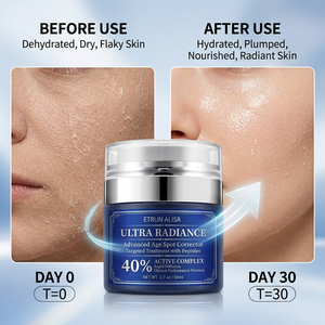 ETRUN ALISA Jour Nuit Correcteur <span class=keywords><strong>Taches</strong></span> Noires Crème Réparatrice Cosmétiques <span class=keywords><strong>pour</strong></span> Tous Types <span class=keywords><strong>de</strong></span> Peau Nicotinamide Vitamine C Crème - Product Image 4