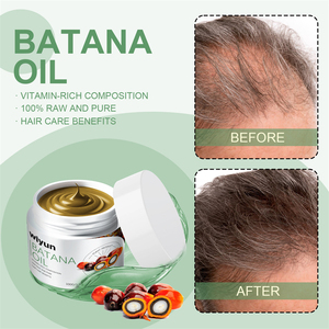 Crema de Aceite de Batana Wiyun 100g, Fortalece las Raíces del Cabello, Previene <span class=keywords><strong>la</strong></span> Caída, Repara, Hidrata y Suaviza el Cabello - Product Image 6