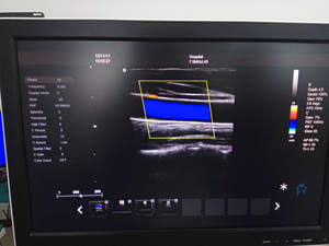 Rumah Sakit portabel warna Doppler Ecograph Harga terbaik 3d dokter hewan portabel warna Doppler Ultrasound - Product Image 6
