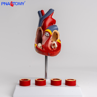 Modelo vascular de trombo de corazón de tamaño natural, simulación de enseñanza de PVC anatómicamente disecable