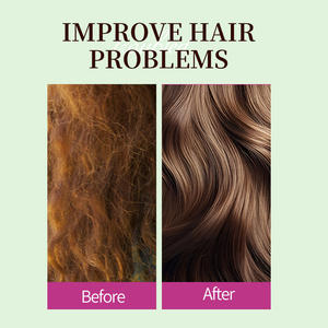 Suero Capilar Clarificante GreenLem ROSEMARYPEPPERMINT - Product Image 3