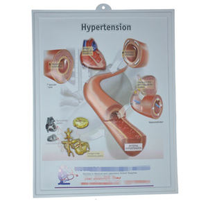 Fabrika kabartmalı 3d PVC grafik tıbbi İdrar yolu grafik anatomisi grafik posteri - Product Image 2