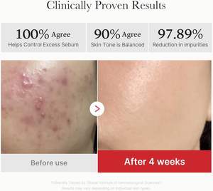 Medicube teslimat stok akne yamalar asit sivilce yama akne çay ağacı Anti akne yama hayır yorumlar henüz - Product Image 6