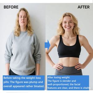 Comprimés de perte de poids de carnitine de baleine animée, usine de source, OEMODM, personnalisation d'étiquettes, amincissant pour adultes - Product Image 6