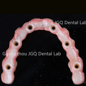 Implant <span class=keywords><strong>dentaire</strong></span> Toutes les couronnes et ponts dentaires <span class=keywords><strong>en</strong></span> céramique avec un <span class=keywords><strong>prix</strong></span> compétitif esthétique élevé - Product Image 3